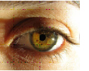 Eye